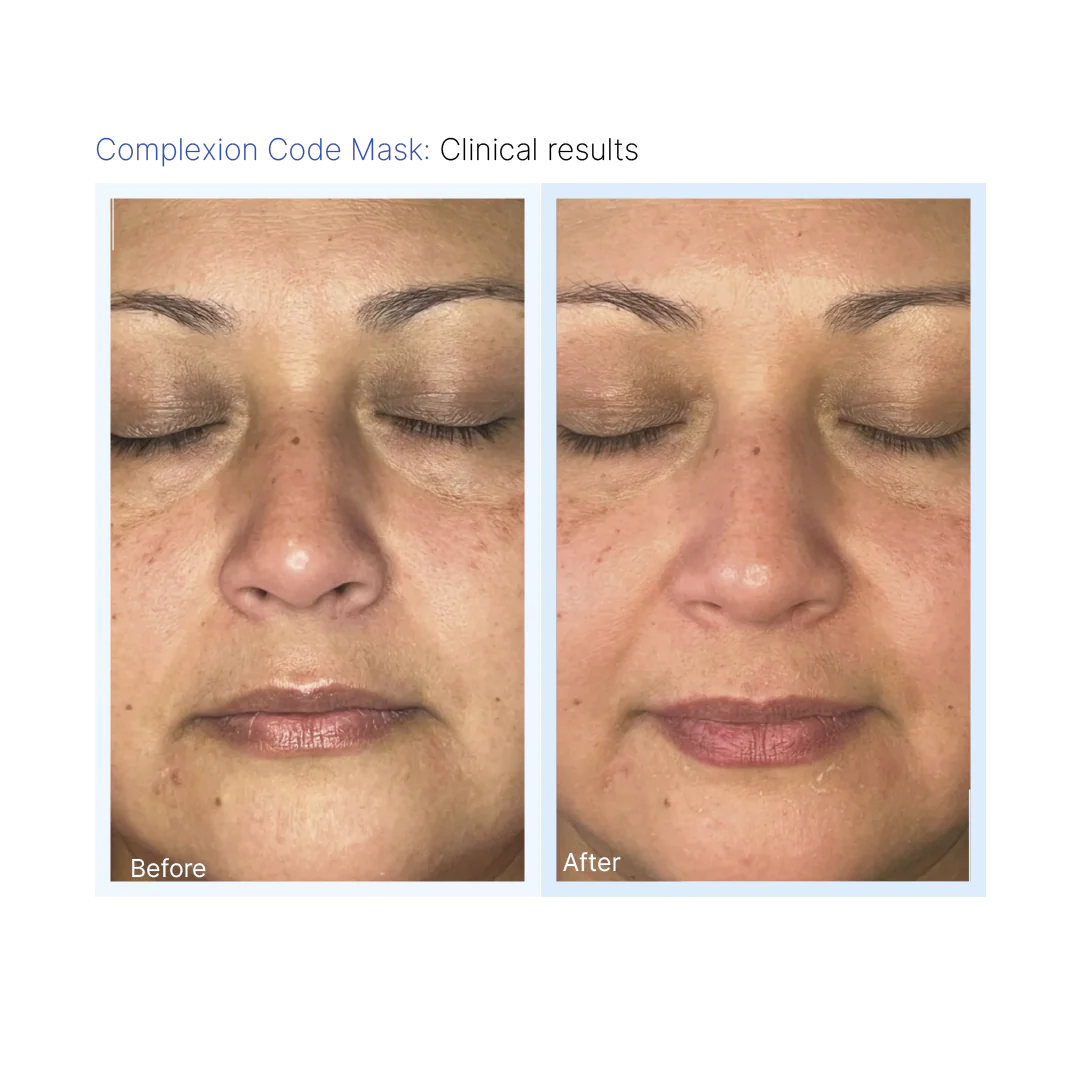 Complexion Code Plus Before & After Pikesville & Baltimore 00002
